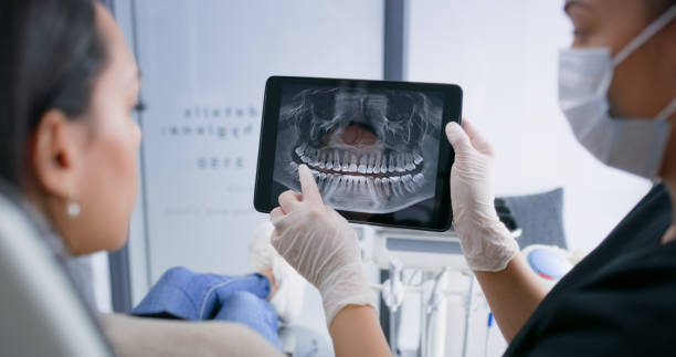 Licensed Tooth Extraction service in Chalfont, PA - Smile Center Dentistry